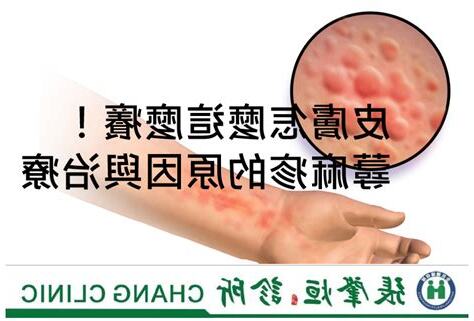 皮膚 癢
